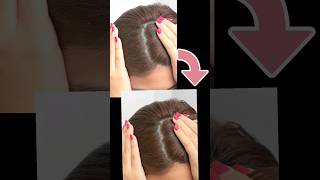 Remove Dandruff in Photoshop Quick amp Easy Tutorial [upl. by Eng88]