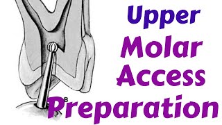 Upper Maxillary Molars  Endodontic Access cavity Preparation Endodontic Lecture amp Tutorial [upl. by Dotson]