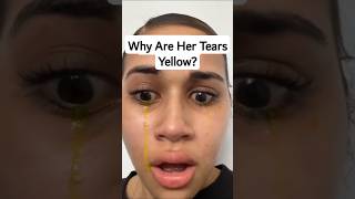 The SHOCKING Reason This Girls Tears Turned YELLOW [upl. by Wynn735]