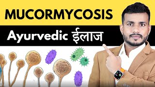 ये MUCORMYCOSISBlack Fungus क्या आयुर्वेद में treatmentblack fungusmucormycosis treatmentEp559 [upl. by O'Donnell]