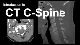 Introduction to CT Cspine Approach and Essentials [upl. by Sherrer534]