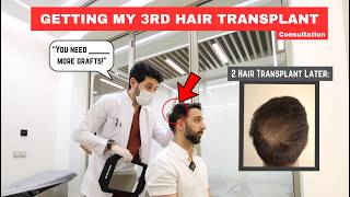 3rd Hair Transplant Heres What the Doctor Said… [upl. by Ybocaj]