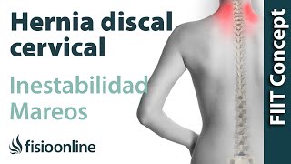 ¿Puede una hernia discal cervical provocar mareos e inestabilidad [upl. by Aliak733]