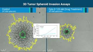 Monitoring and Quantifying 3D Spheroid Invasion by RTCA eSight Live Cell Analysis System [upl. by Trow55]