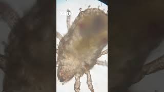 Microscopic Mite music microscope ponds bug evolution life cell tiny microbiology [upl. by Kayley]