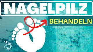 🚀NAGELPILZ NATÜRLICH BEHANDELN🚀 12 Hausmitel gegen Nagelpilz Nagelpilz Behandlung leicht gemacht [upl. by Anan171]