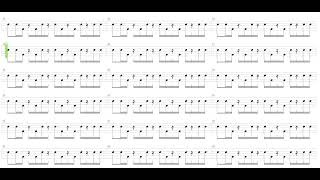 Myxomatosis  Radiohead  Drum only  Drum tab [upl. by Cobby]