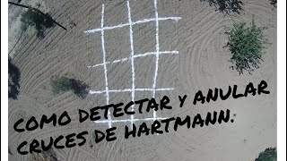 COMO DETECTAR y ANULAR CRUCES DE HARTMANN [upl. by Standice712]