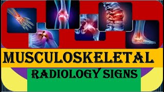 MSK radiological signs [upl. by Esya]