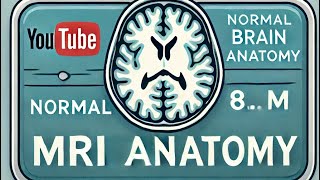 quotUnderstanding Normal Brain MRI Anatomy  Explained in Simple Termsquot [upl. by Annoerb]