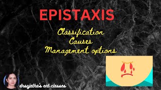 250EpistaxisClassificationCauses Diagnosis and Management plans [upl. by Slaohcin]