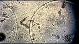 Strongyloides stercoralis no exame de urina EAS [upl. by Maryanna]