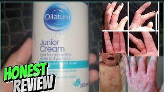 Oilatum Review Moisturise dry itchy scaly skin conditions cure eczema dermatitis skincareproducts [upl. by Hopkins]