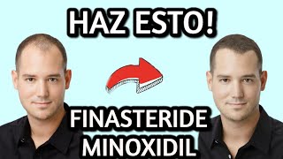 FINASTERIDE y MINOXIDIL Tratamiento ALOPECIA Como usarlos Efectos secundarios [upl. by Rexana919]