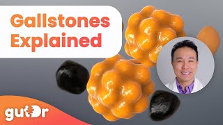 Gallstones  What Are the Causes and Symptoms  The GutDr Explains 3D Gut Animation [upl. by Dnomzed464]