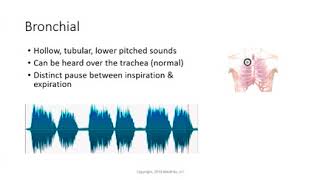 Bronchial breath sounds [upl. by Elletnahc]