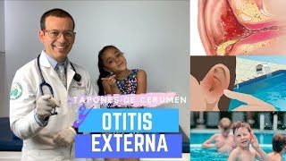 TAPON DE CERUMEN COMO CAUSA DE OTITIS EXTERNA [upl. by Orrin]