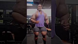 The Dark Side of Synthol Bodybuilders Destroyed by Oil [upl. by Pugh]