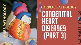 CARDIAC PATHOLOGY CONGENITAL HEART DISEASES part3 lecture16 pathology robbins pathoma mbbs [upl. by Eitsyrc482]