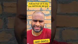 15 day use adivasi hair oil use क्या हुआ result dekho adivashioil hairfall shortvideo viral [upl. by Eilagam245]