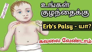 Erbs Palsy என்றால் என்னCausesSymptoms physiotherapy Treatment in TamilDrSasiDuraiPhysioTamil [upl. by Amahs]