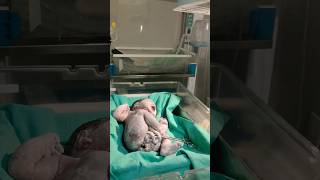 vernix cleaning 👌newbornbaby baby beautiful babycare new viral youtubeshorts new trending [upl. by Ullyot684]