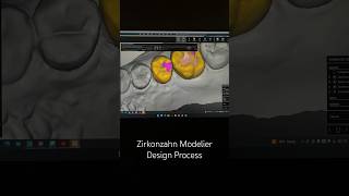 Zirkonzahn Modellier Design dental cadcam digitaldentistry [upl. by Miles75]