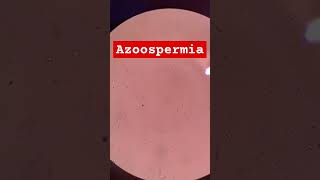 Azoospermia microscopio microscopia embarazo baby microscopico [upl. by Aikrehs451]