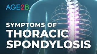 What Are the Symptoms of Thoracic Spondylosis Thoracic MidBack Pain or Disc Spondylolisthesis [upl. by Crisey69]