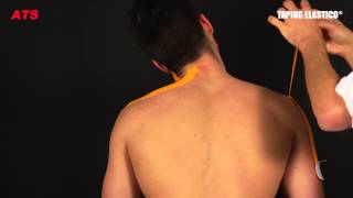 Taping Elastico®  Applicazione Cervicale [upl. by Zelle]