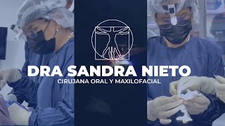 IMPLANTES FACIALES PERSONALIZADOS 🔥  MEJORA TU MENTÓN PÓMULOS Y ÁNGULOS MANDIBULARES [upl. by Airretnahs927]