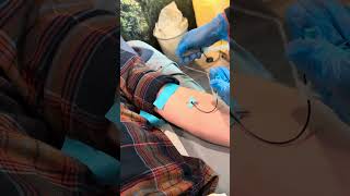 Insertion of closed catheter IV and saline flush demonstration [upl. by Ylhsa166]