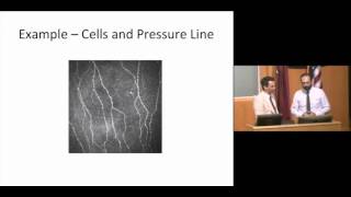 Corneal confocal microscopy image analysis part 3 [upl. by Congdon448]