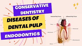 ADC part 1 exam  A simple way to diagnose pulpal diseases [upl. by Llerat]