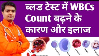 High Wbcs Count In Blood  ब्लड में WBCs बढ़ने के कारण और इलाज  High Wbc Count Treatment In Hindi [upl. by Sharla]