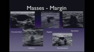 Ultrasound Imaging of the Breast – Lesion Characterization [upl. by Rorke]