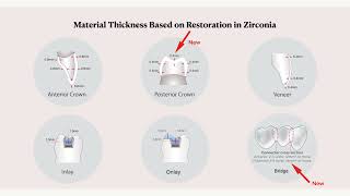 Zirconia 101 3 of 11 Preparation Indications for zirconia [upl. by Worthington274]