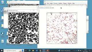 Fiji tip 3 Measuring particle sizes within an area using Fiji ImageJ software [upl. by Naneek]