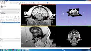 4 3D Slicer  Create Anatomical Fiducials for Stereotaxic Alignment [upl. by Myers]