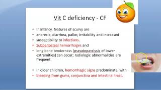 Pediatrics 133 Scurvy Vitamin C deficiency child infant treat clinical feature xray finding Frankel [upl. by Anrev]