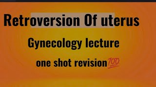 RETROVERSION OF UTERUS  Gynecology lecture [upl. by Verlee105]