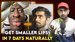 How To Get Thin LIPS Naturally  Hindi   Get Smaller Lips Easily 100 Result Aditya Shubham [upl. by Ttereve253]