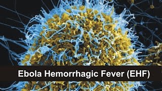 Ebola Hemorrhagic Fever EHF [upl. by Llennahs172]