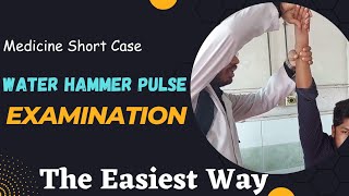 Examination of Water Hammer Pulse [upl. by Ilil]