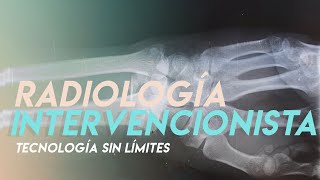 ¿Qué es un Técnico Radiólogo Intervencionista  Tecnología sin Límites [upl. by Yeldud]