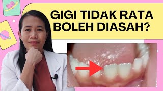 Gigi tidak rata seperti ini bisa diasah [upl. by Cello66]