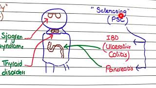 Primary Biliary Cholangitis and Primary Sclerosing Cholangitis  Pathology [upl. by Eiramanad185]