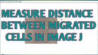 Wound healing assay analysis by image J II xgene and proteinx [upl. by Oinotna]