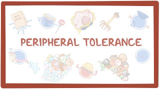 Peripheral Tolerance causes symptoms diagnosis treatment pathology [upl. by Gamages]