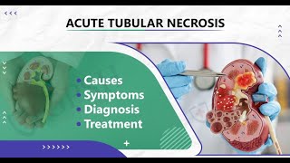 Acute Tubular Necrosis Symptoms and Causes  Diagnosis  Treatment  Prevention [upl. by Garaway315]